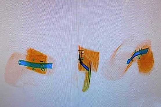 جاسازی عجیب مواد مخدر در فرودگاه /تصاویر
