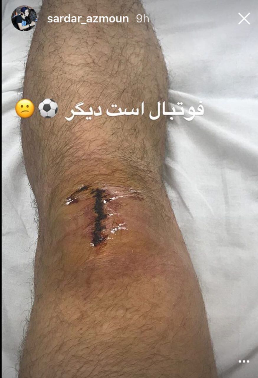 تصویری از جراحت زانوی سردار آزمون